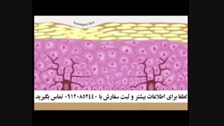 خرید کرم ضد لک فروشگاه 5040-666-0902