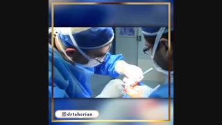 فیلم جراحی بینی