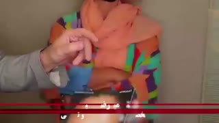 لیفت آندوسکوپی ابرو