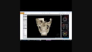 دمو تدریس رادیو دوره اصلی استاد دکتر  درفشی آمادگی آزمون رزیدنتی(ماهان-نوآوران دانش)