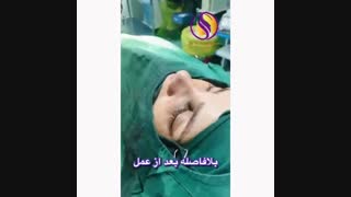 جراحی زیبایی بینی