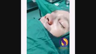 نمونه ای از عمل بینی مردانه