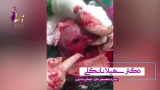 فیلم واقعی سزارین سوم