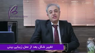 علت بزرگ شدن بینی بعد از عمل