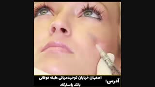 فیلر گونه آکنه