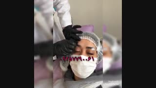 آموزش لیفت ابرو با نخ 09357790061