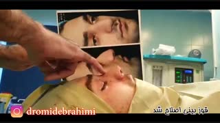 عمل بینی گوشتی قوزدار توسط دکتر امید ابراهیمی