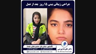 جراحی زیبائی بینی