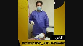 تزریق چربی گونه برداشتن خال گوشتی