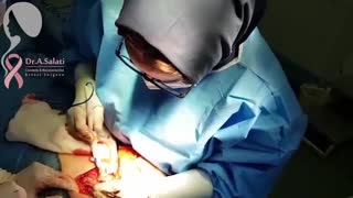 ماستکتومی یا برداشتن کل پستان در یک خانم با سرطان پیشرفته پستان