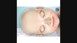 چگونه بعد از عمل زیبایی بینی، آن را شست و شو دهیم؟