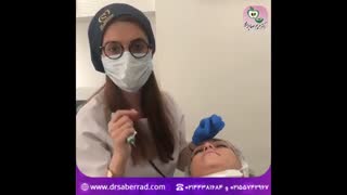 اصلاح فرم بینی