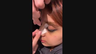 فیلم چسب زدن به بینی بعد از عمل