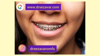 اصلا روابط فکی