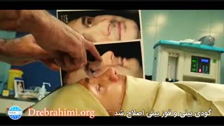 فیلم عمل ترمیمی بینی