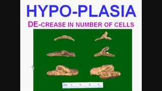 Pathology chapter 1b