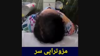 مزوتراپی موی سر