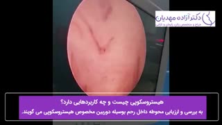 فیلم واقعی بررسی رحم با جراحی هیستروسکوپی