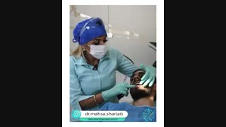 اجزای اصلی درمان ارتودنسی ثابت