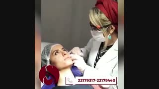 فیلم واقعی لیفت صورت با پروفایلو