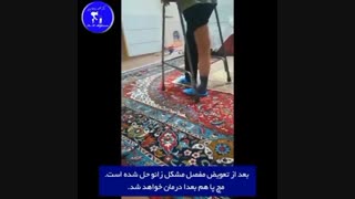 تخریب شدید زانو به دلیل فلج اطفال