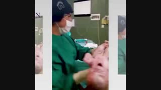 فیلم واقعی زایمان سزارین