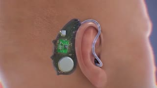 اجزا و عملکرد سمعک به زبان فارسی