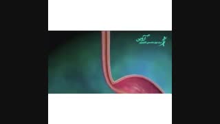 همه چیز در رابطه با سرطان مری