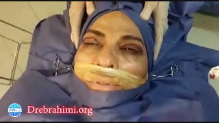 فیلم عمل بینی گوشتی همراه با عمل پلک