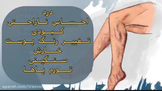 علت ایجاد واریس چیست؟ دکتر مهرداد اقدسی زاویه سازی صورت
