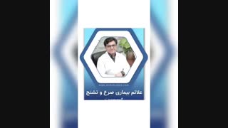 علائم بیماری صرع و تشنج