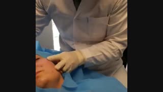 فیلم سابسیژن صورت
