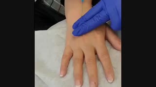 تزریق ژل پروفایلو به دست جهت جوانسازی و آبرسانی پوست
