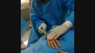 فیلم تزریق چربی به دست