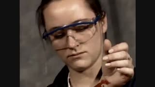 کنترل خونریزی