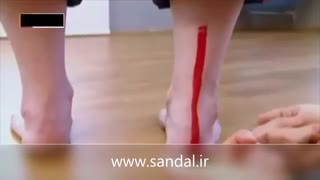 علل درد کف پا بویژه در خانمها
