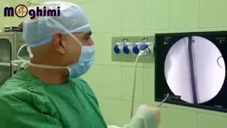 عمل شکستگی استخوان بازو در خانم جوان ورزشکار به روش اینترامدولاری