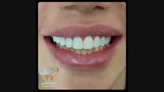 فیلم از درمان انجام شده | دکتر حامد صالحی