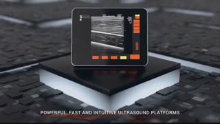 دستگاه تصویربرداری اولتراسونیک پرتابل EvoTouch