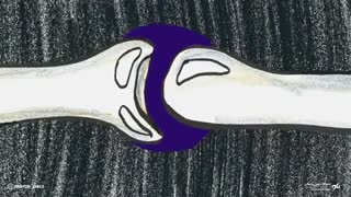 داستان شکستن قولنج