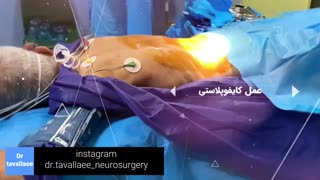 فیلم عمل کایفوپلاستی یا تزریق سیمان