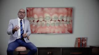 عکس های قبل و بعد ارتودنسی | دکتر داودیان