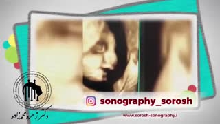 سونوگرافی از جنین خوشگلمون