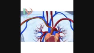 فیلم آنژیوپلاستی قلب