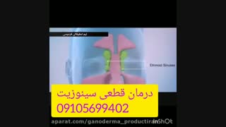 درمان سیاتیک بدون نیاز به جراحی