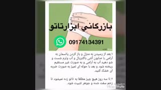 مراقبت های بعد ازتاتو پر کردن دندان