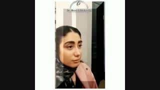 عمل بینی بدون درد!!!!