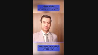 درمان بیماری پوستی ویتیلیگو