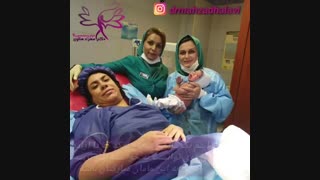 زایمان سزارین