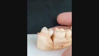 آنلی زیرکونیا
